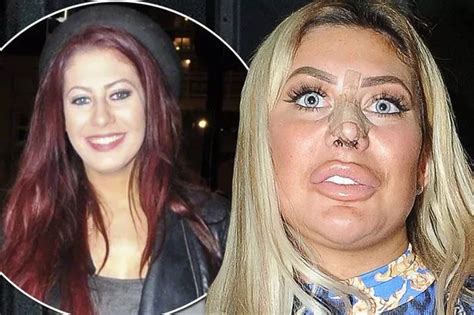 chloe ferry 2017|chloe ferry before surgery.